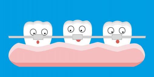 厦门牙齿矫正中橡皮圈起着哪些重要作用