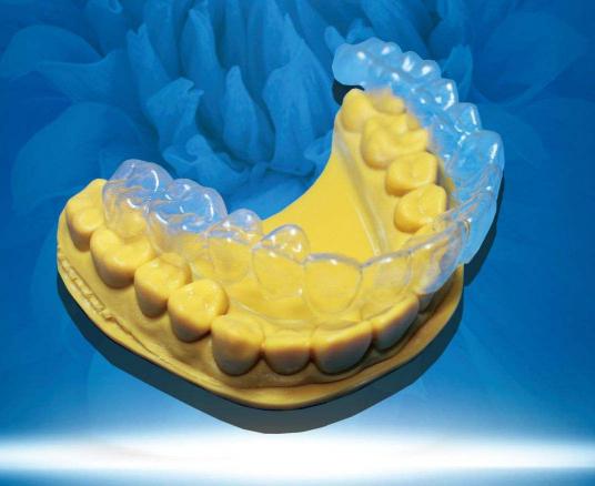 厦门正畸治疗中牙根吸收的原理及影响因素