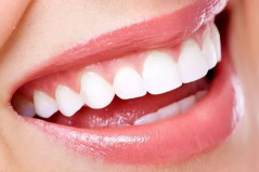 厦门牙齿修复有几种方法？