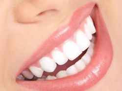 厦门牙齿修复做牙套和牙齿贴面哪个好